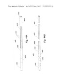 Systems And Methods For Removing Obstructive Matter From Body Lumens And     Treating Vascular Defects diagram and image