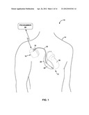 DIAGNOSIS AND THERAPY OF BIGEMINY AND FREQUENT PREMATURE CONTRACTIONS diagram and image