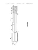 STENT DELIVERY SYSTEM diagram and image