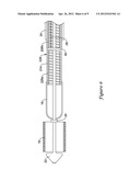 STENT DELIVERY SYSTEM diagram and image