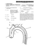 DELIVERY SYSTEM FOR BRANCHED STENT GRAFT diagram and image