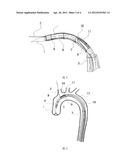 DELIVERY SYSTEM FOR BRANCHED STENT GRAFT diagram and image