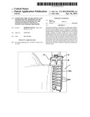 ENDOSCOPIC IMPLANTABLE DEVICE AND METHOD FOR THE APPOSITION OF THE STOMACH     WALLS FOR REDUCING THE STOMACH INTERNAL VOLUME IN A WEIGHT LOSS SURGERY     PROCEDURE diagram and image