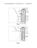 ENDOSCOPIC IMPLANTABLE DEVICE AND METHOD FOR THE APPOSITION OF THE STOMACH     WALLS FOR REDUCING THE STOMACH INTERNAL VOLUME IN A WEIGHT LOSS SURGERY     PROCEDURE diagram and image