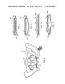 DYNAMIC SUPPORT APPARATUS AND SYSTEM diagram and image