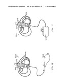 DYNAMIC SUPPORT APPARATUS AND SYSTEM diagram and image