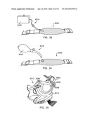 DYNAMIC SUPPORT APPARATUS AND SYSTEM diagram and image