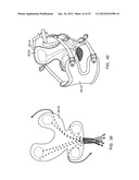 DYNAMIC SUPPORT APPARATUS AND SYSTEM diagram and image