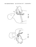 DYNAMIC SUPPORT APPARATUS AND SYSTEM diagram and image