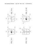 FOREHEAD SUPPORTS FOR FACIAL MASKS diagram and image