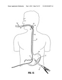 SURGICAL TILT ANVIL ASSEMBLY diagram and image