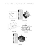 ANTENNA diagram and image