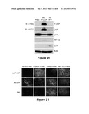 Method for therapeutic angiogenesis diagram and image