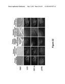 Method for therapeutic angiogenesis diagram and image