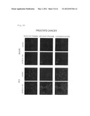 ANTIBODY HAVING ANTI-CANCER ACTIVITY diagram and image