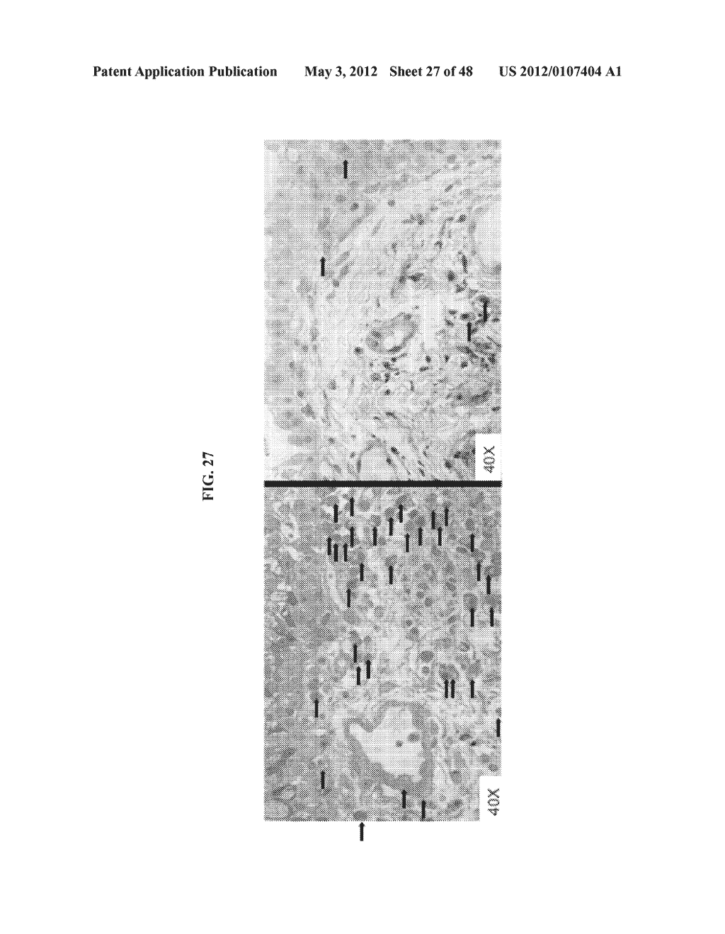 Crystalline Pharmaceutical and Methods of Preparation and Use Thereof - diagram, schematic, and image 28
