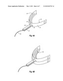 Ultrasonic Dental Treatment System diagram and image