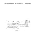 DENTAL PROPHYLAXIS ANGLE AND HANDPIECE ASSEMBLY diagram and image