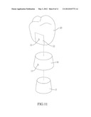 MOUNTING STRUCTURE OF INTERNAL AND EXTERNAL CROWNS diagram and image