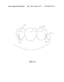 MOUNTING STRUCTURE OF INTERNAL AND EXTERNAL CROWNS diagram and image