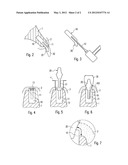 ZIRCONIUM OXIDE-BASED DENTAL IMPLANT AND METHOD FOR PRODUCING SAID DENTAL     IMPLANT diagram and image