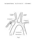 INTERNAL DRIVE LINE FOR VENTRICULAR ASSIST DEVICE diagram and image
