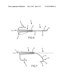 Steerable sheath access device diagram and image