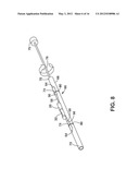 Implantable Medical Sensor and Fixation System diagram and image