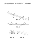 Implantable Medical Sensor and Fixation System diagram and image