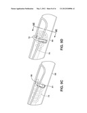 Implantable Medical Sensor and Fixation System diagram and image