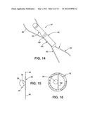 Implantable Medical Sensor and Fixation System diagram and image