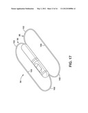 Implantable Medical Sensor and Fixation System diagram and image