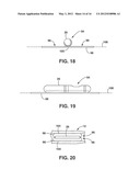 Implantable Medical Sensor and Fixation System diagram and image