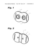 APPARATUS AND METHOD FOR ULTRASONIC SPINE TREATMENT diagram and image