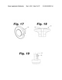 APPARATUS AND METHOD FOR ULTRASONIC SPINE TREATMENT diagram and image