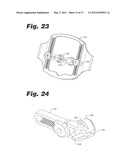 APPARATUS AND METHOD FOR ULTRASONIC SPINE TREATMENT diagram and image