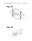 APPARATUS AND METHOD FOR ULTRASONIC SPINE TREATMENT diagram and image