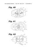 APPARATUS AND METHOD FOR ULTRASONIC SPINE TREATMENT diagram and image