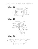 APPARATUS AND METHOD FOR ULTRASONIC SPINE TREATMENT diagram and image