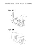 APPARATUS AND METHOD FOR ULTRASONIC SPINE TREATMENT diagram and image