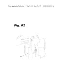 APPARATUS AND METHOD FOR ULTRASONIC SPINE TREATMENT diagram and image