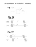 APPARATUS AND METHOD FOR ULTRASONIC SPINE TREATMENT diagram and image