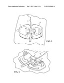 SPECIALIZED CATHETER SECUREMENT DEVICES FOR PERIPHERALLY INSERTED CENTRAL     CATHETERS diagram and image