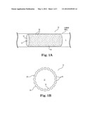 THERAPEUTIC AGENT DELIVERY SYSTEM AND METHOD FOR LOCALIZED APPLICATION OF     THERAPEUTIC SUBSTANCES TO A BIOLOGICAL LUMEN diagram and image