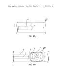 THERAPEUTIC AGENT DELIVERY SYSTEM AND METHOD FOR LOCALIZED APPLICATION OF     THERAPEUTIC SUBSTANCES TO A BIOLOGICAL LUMEN diagram and image