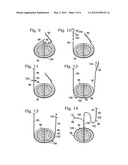 REPLACEMENT SYSTEM FOR A SURGICAL WIRE diagram and image