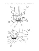 DEVICE FOR IN SITU MILLING OF JOINT SURFACES diagram and image