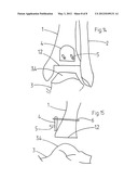 DEVICE FOR IN SITU MILLING OF JOINT SURFACES diagram and image