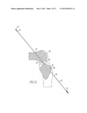 Device And Method For Use During Ligament Reconstruction diagram and image