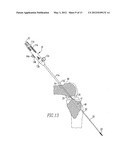 Device And Method For Use During Ligament Reconstruction diagram and image